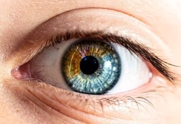  مشکلات بینایی و نابینایی از عوارض جراحی تغییر رنگ چشم است 